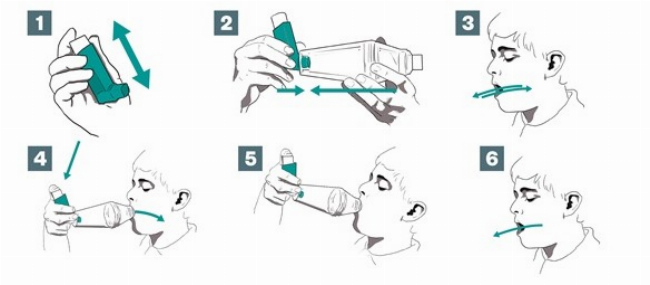 Hình ảnh bình xịt định liều MDI và hướng dẫn sử dụng cơ bản